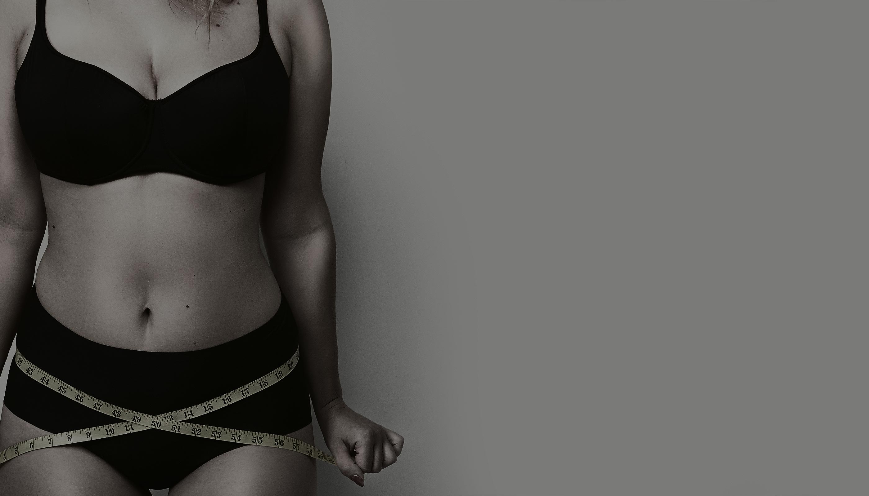 CIRURGIA PÓS-BARIÁTRICA